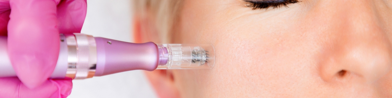 Minimizes Pores