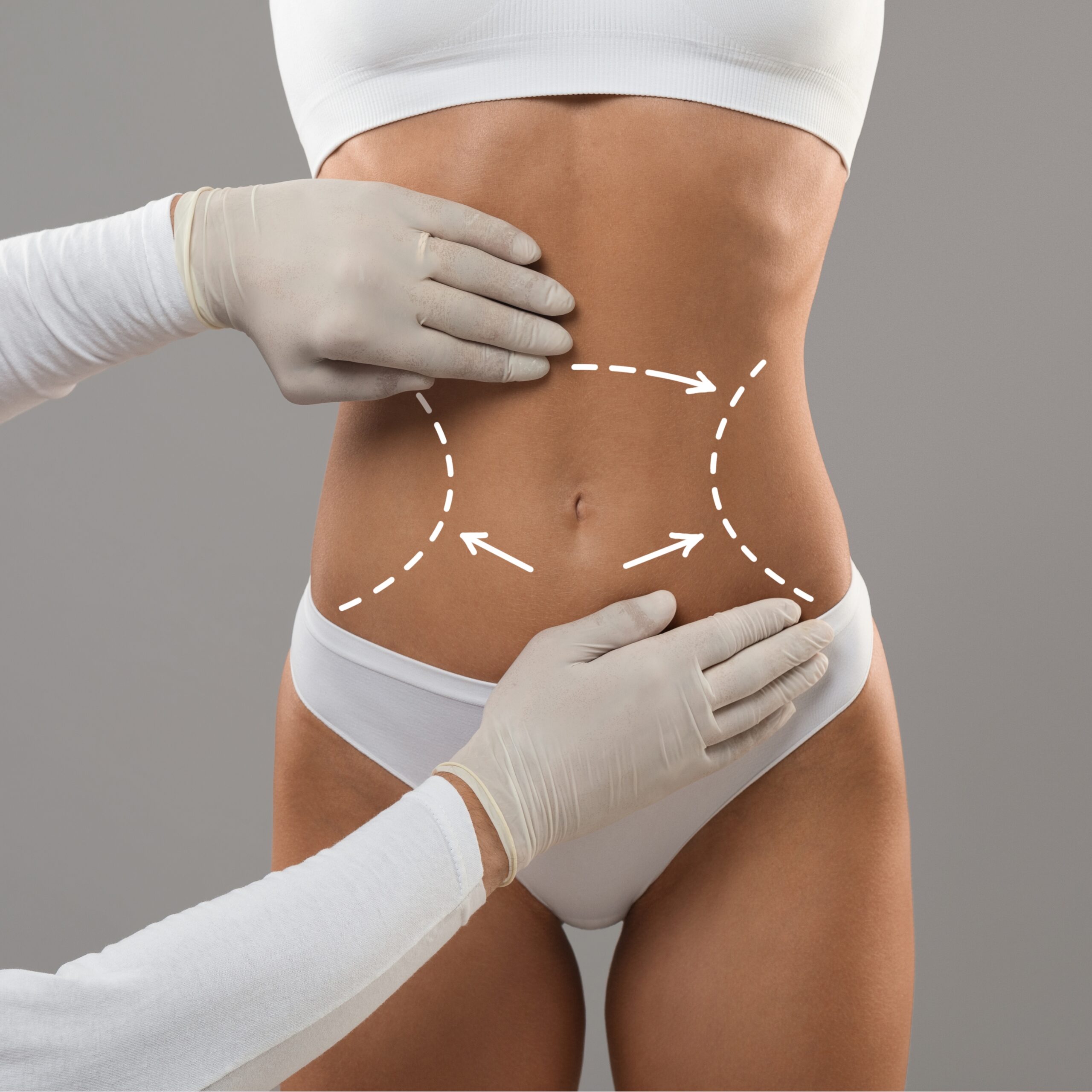 coolsculpt