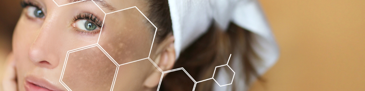 Hyperpigmentation treatment