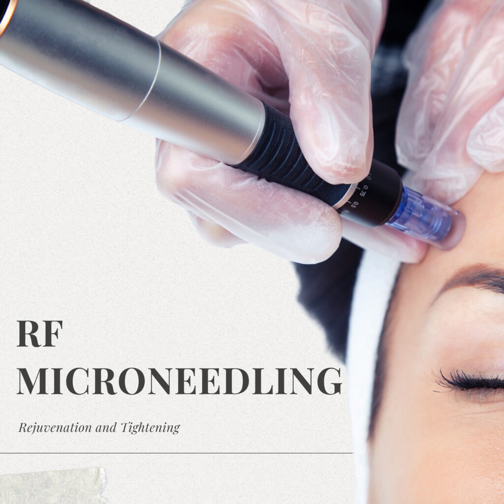 RF Microneedling, Skin rejuvenation, Skin tightening treatment, Anti-aging skin treatments, Acne scar reduction, RF Microneedling benefits, Collagen boosting treatments, Non-surgical skin tightening, Minimally invasive skin treatments, Advanced skincare solutions, Radiofrequency microneedling, Best RF Microneedling clinic, Skin texture improvement, Safe skin rejuvenation treatments, RF Microneedling for scars.