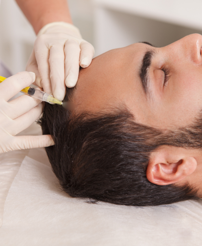 GFC Therapy (Growth Factor Concentrate) – Hair Regrowth